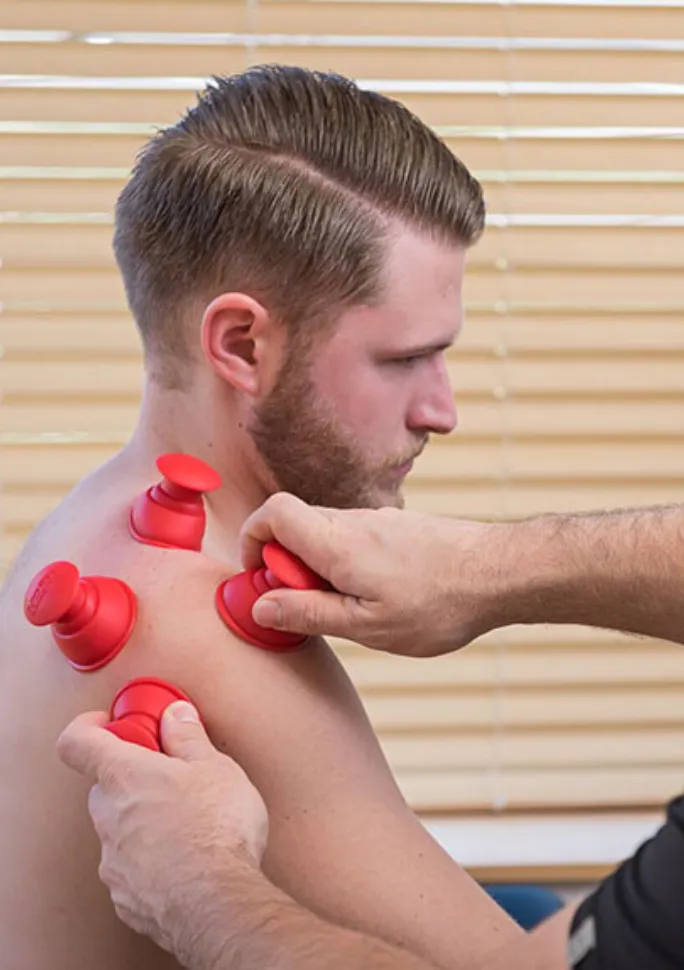 Silicone cupping therapy applied to a patient's back